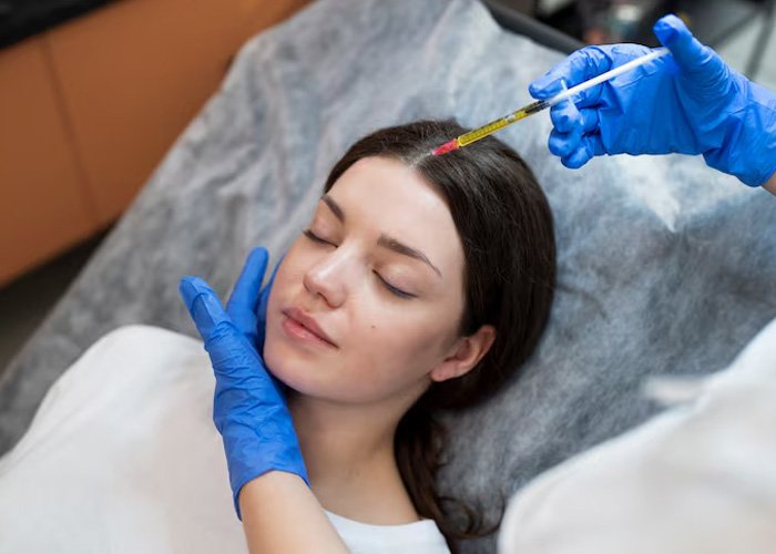 PRP Treatment