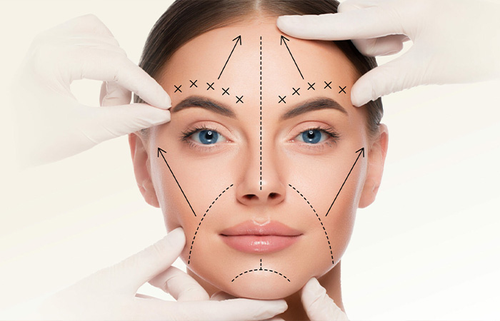 Facelift Treatment